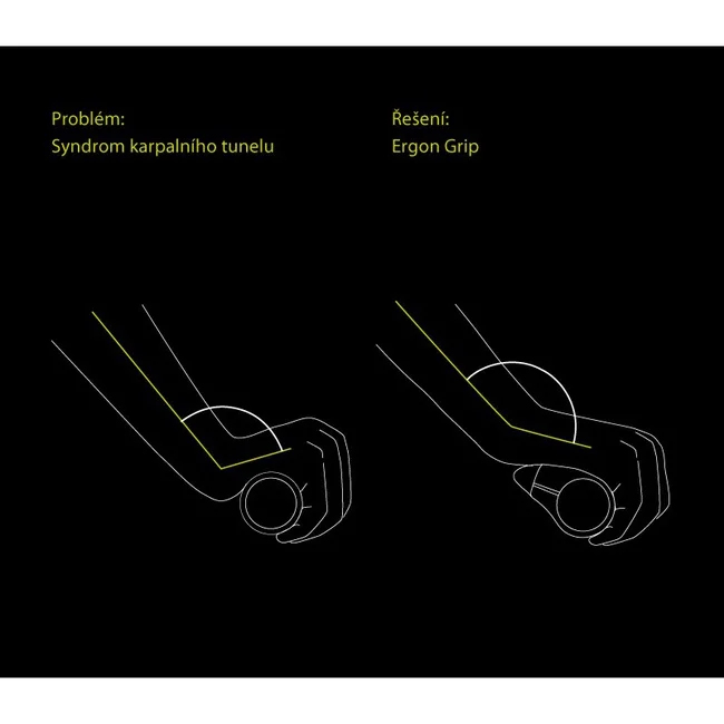 Rohy na kolo ERGON GP4-L - syndrom karpálního tunelu
